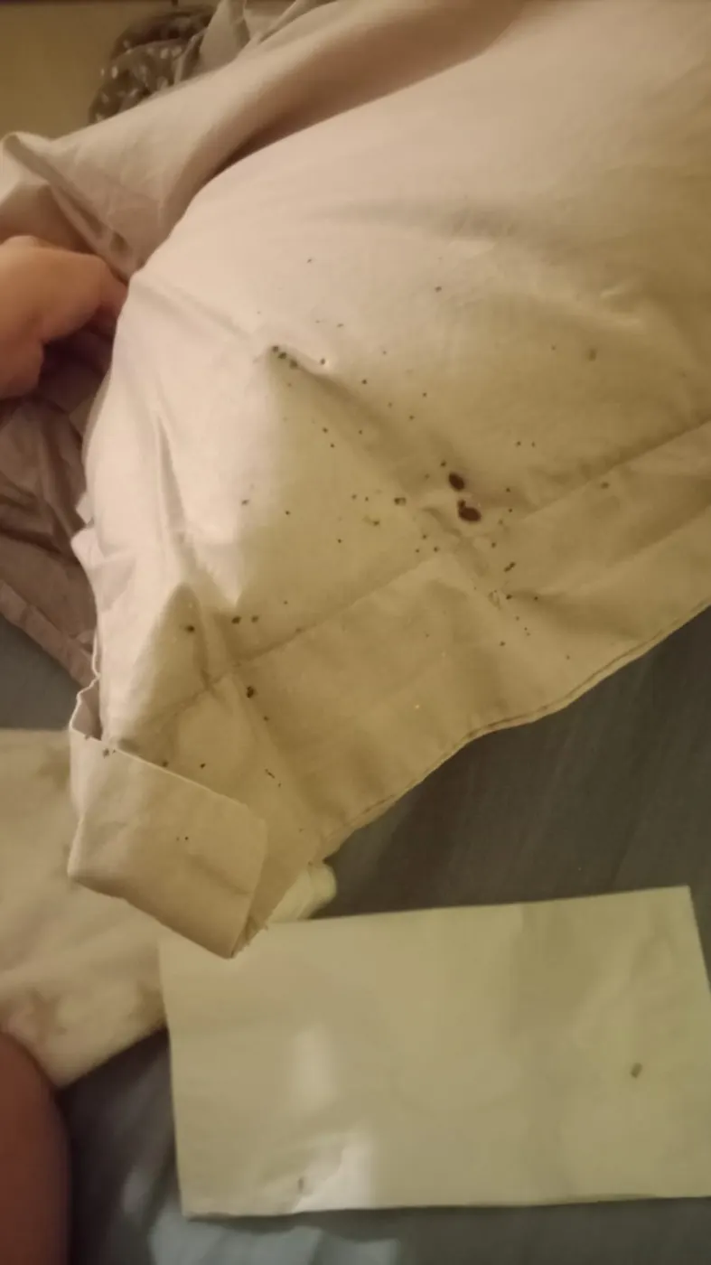 Contrôle d'un textile lors de l'intervention